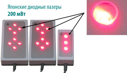 Аппарат лазерного липолиза ADSS FG 660H-002